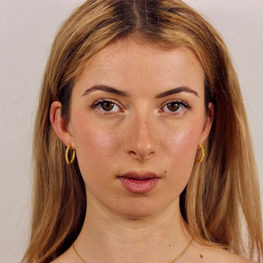 Artemis Hoops